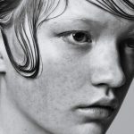 Hair Transplant Surgeons Share Everything You Need to Know