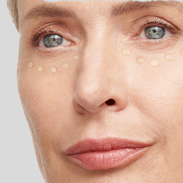 Under-eye filler with hyaluronic acid
