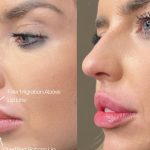 The Global Aesthetic Visionary Behind the Signature Lips – Hollywood Life