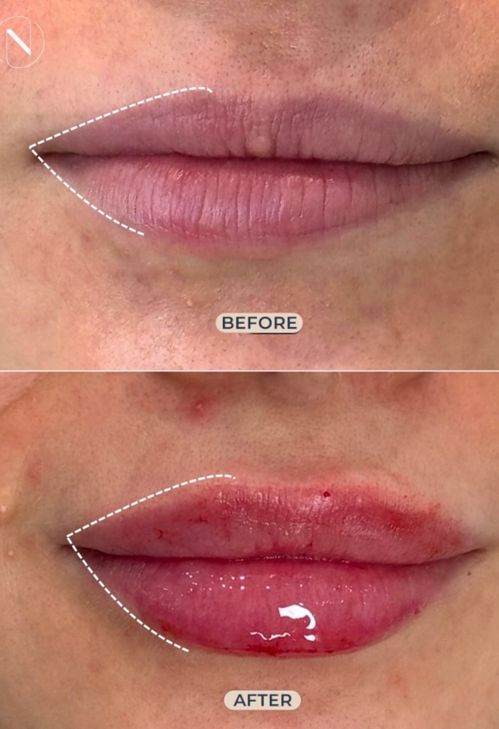 Narjis Al Saedy: The Global Aesthetic Visionary Behind the Signature Lips